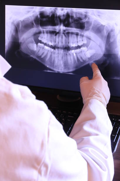 Best Emergency Broken Tooth Repair in Thomasville, NC